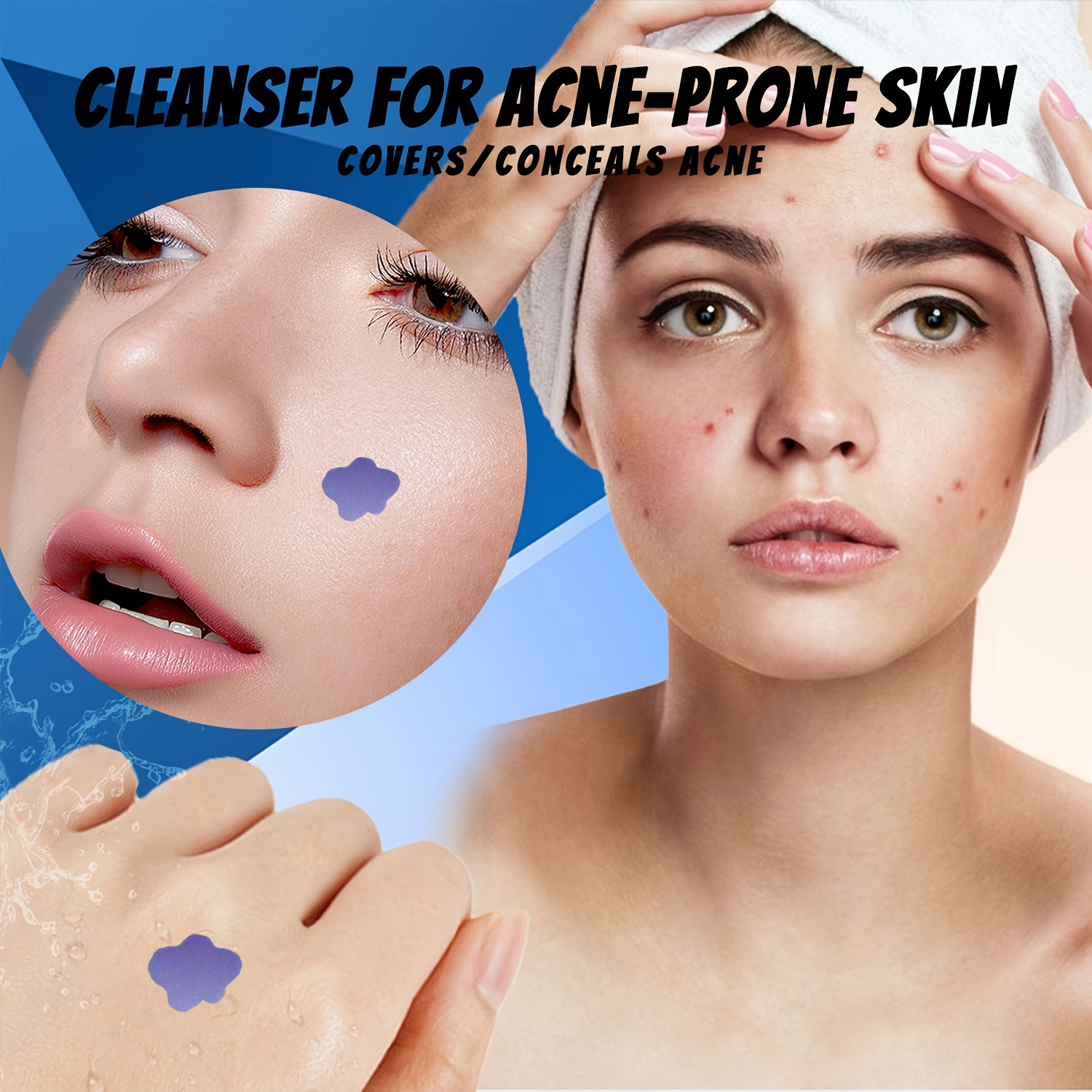 Mikroiğneli Akne Sivilce Bandı - Skincare You incelemesi ve fiyatı
